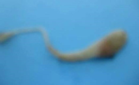 Trung ran co the nam trong long do trung ga hay khong? hinh anh