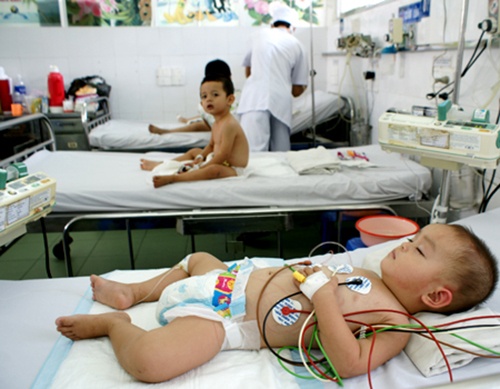 Tuong con tieu chay, hoa ra viem mang nao mu hinh anh