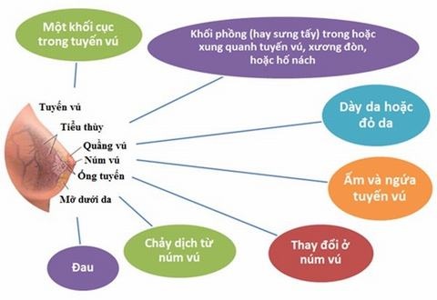Các dấu hiệu cảnh báo ung thư mà bạn có thể tự kiểm tra tại nhà. 