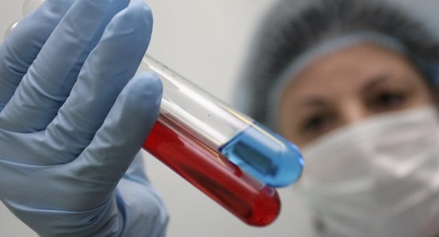 Phat hien 'sieu khang the' tieu diet virus HIV hinh anh