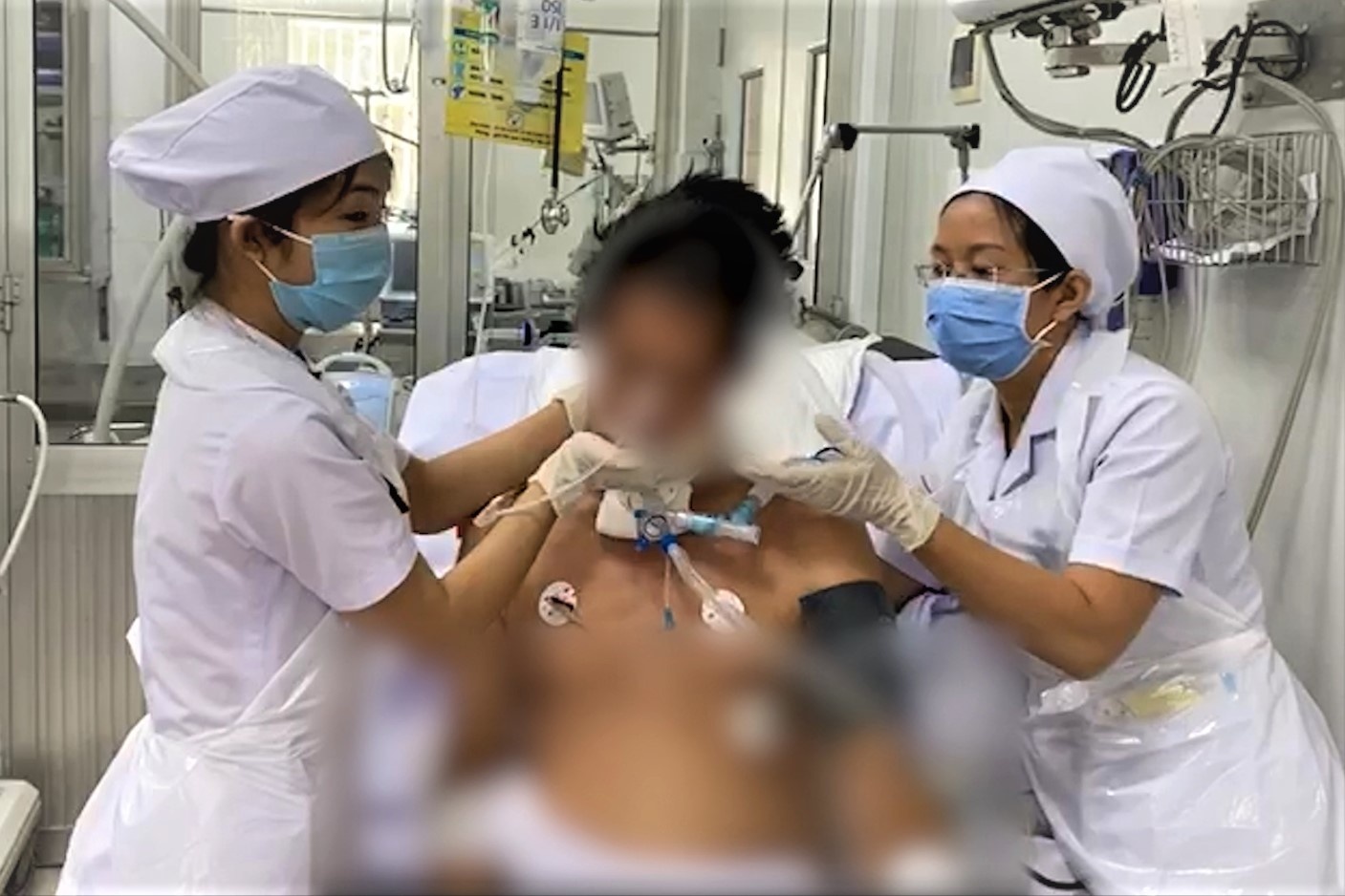 Benh nhan ngo doc pate Minh Chay co the cu dong tay, chan hinh anh