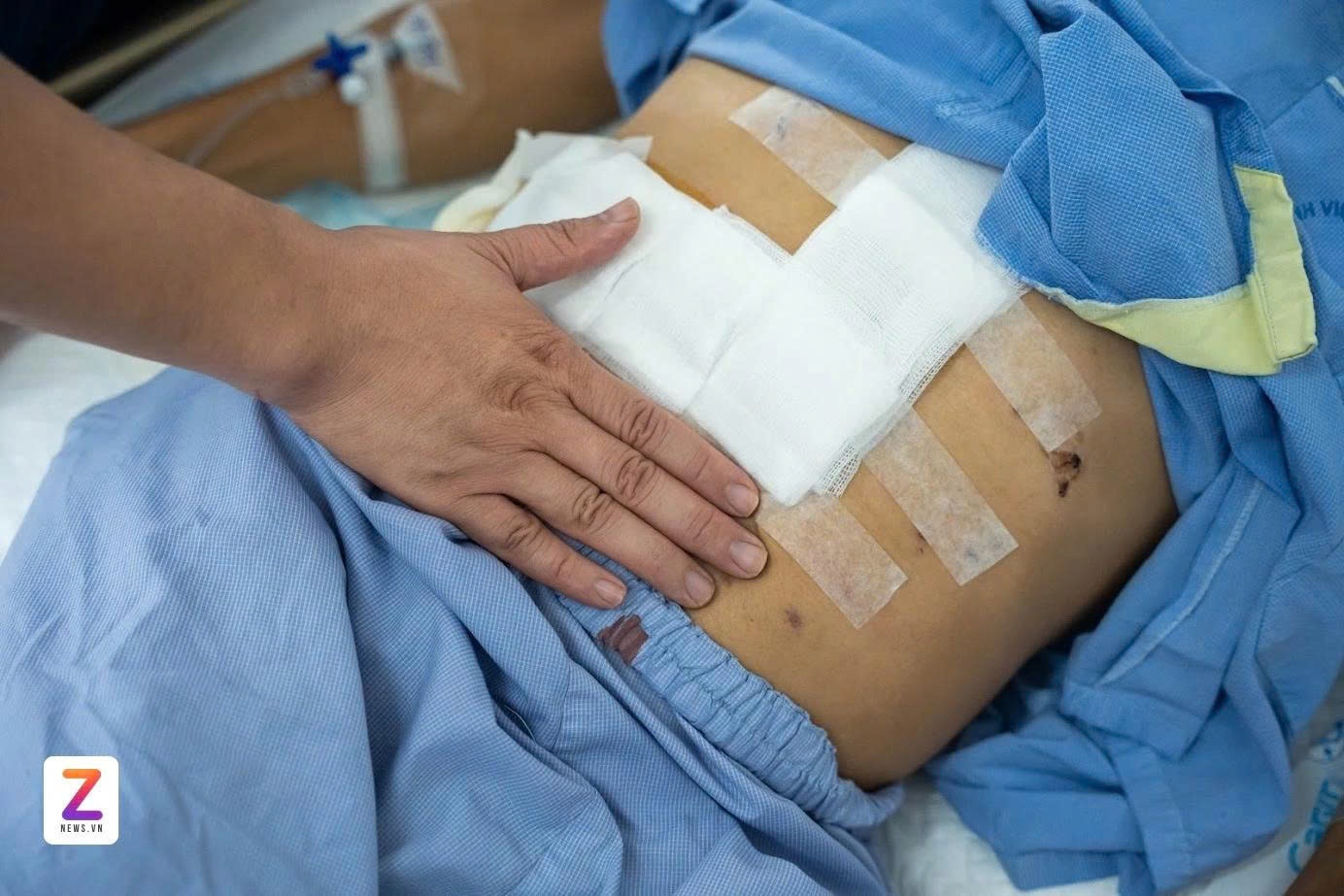 vi&ecirc;m gan,  rượu bia  ảnh 1