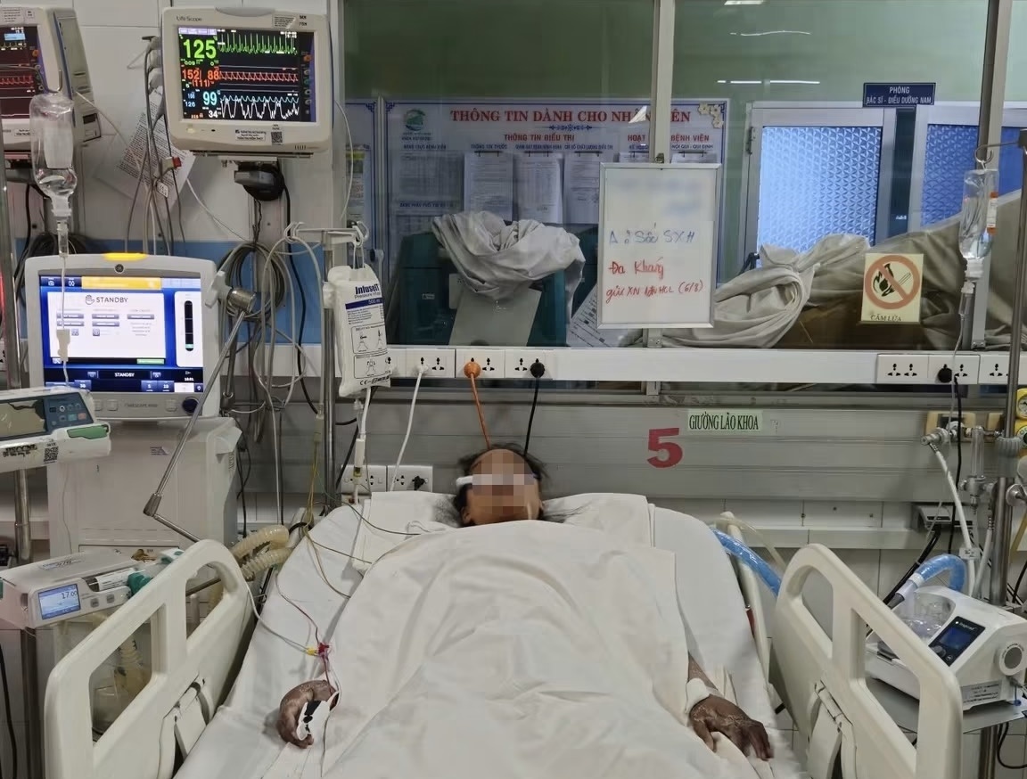 sốt xuất huyết ảnh 3