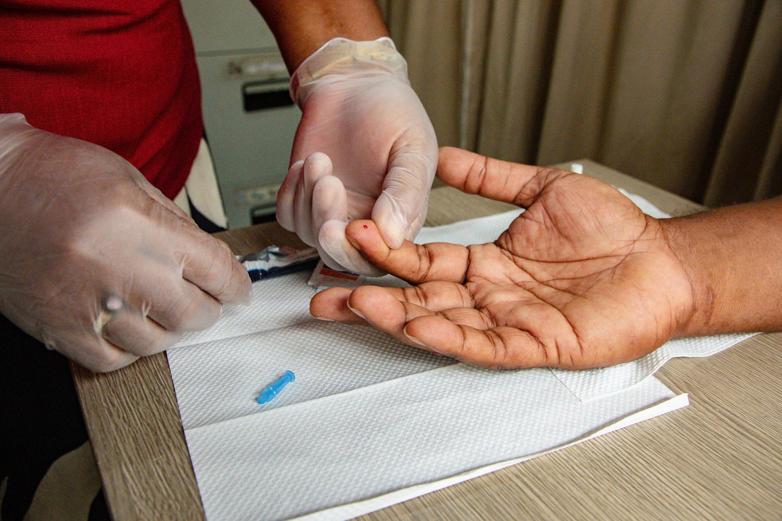 HIV ảnh 5