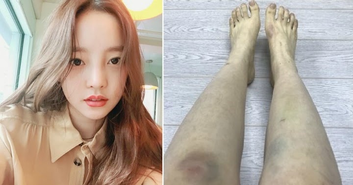 Goo Hara khiến Hàn Quốc quyết tâm thay đổi ảnh 4 Goo Hara khien Han Quoc quyet tam thay doi anh 4