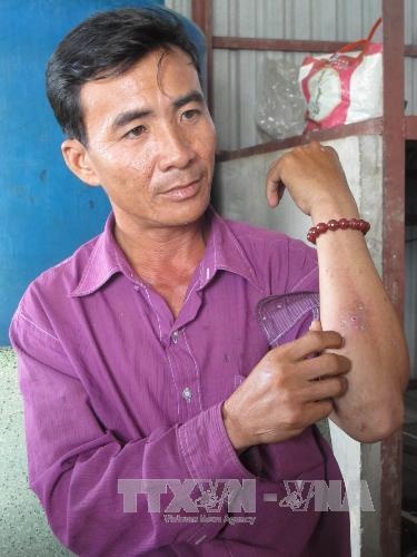 Kien ba khoang dot anh 1