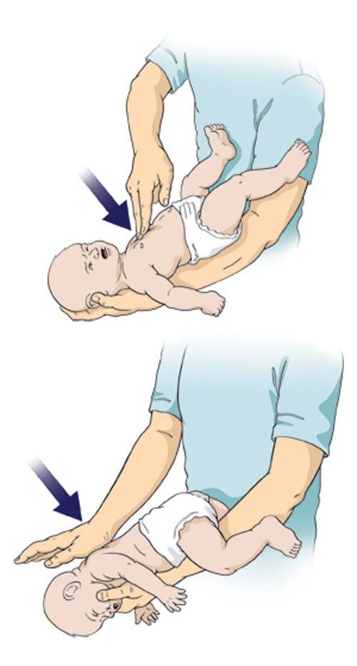 Sơ cứu bị hóc ảnh 2 So cuu bi hoc anh 2