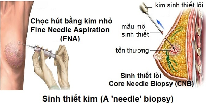 6 xet nghiem giup phat hien som ung thu hinh anh