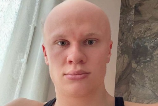 Haaland lam CDV ngo ngang hinh anh