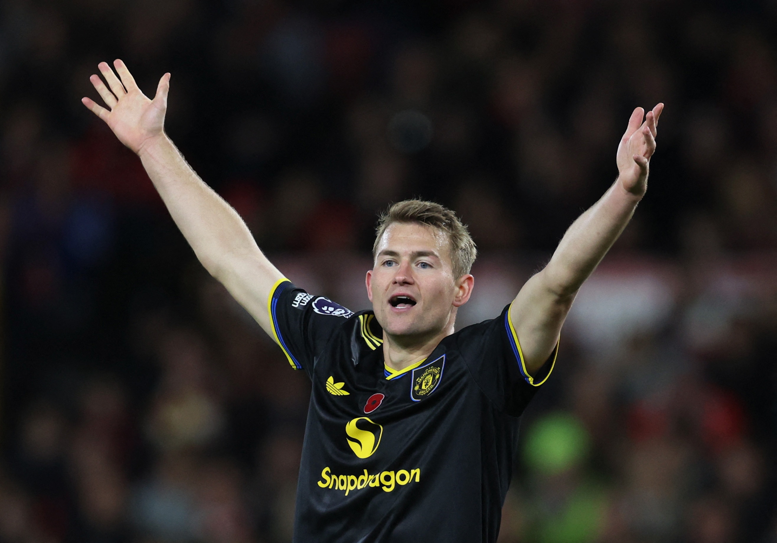 MU bi doi hang 18 cam hoa hinh anh