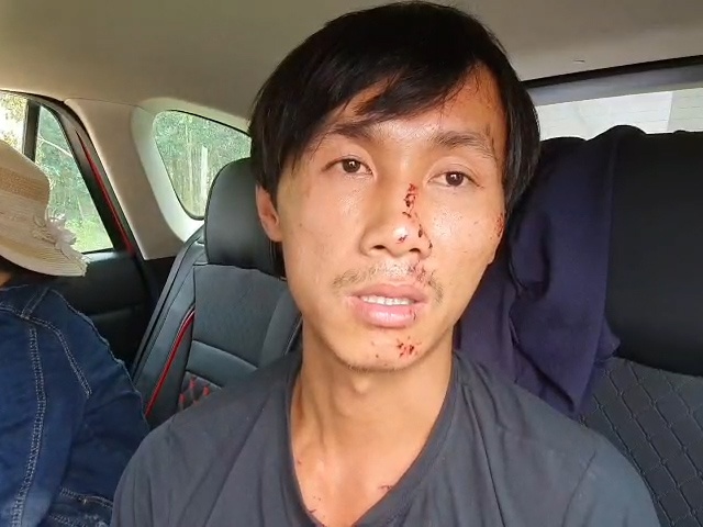 Tai xe xe tai ke luc oto 16 cho dau dau khien 8 nguoi chet hinh anh