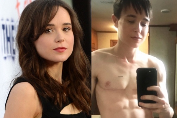 Sao ‘X-Men’ khoe co bung san chac sau phau thuat chuyen gioi hinh anh