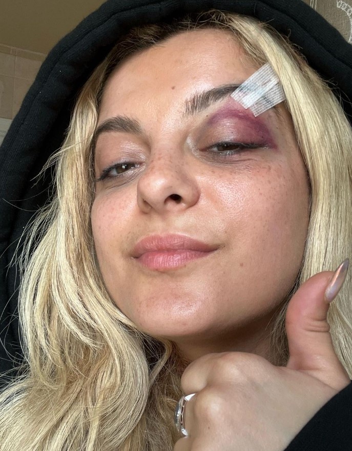 Bebe Rexha, nhạc US UK, tấn công ảnh 1 Bebe Rexha, nhac US UK, tan cong anh 1