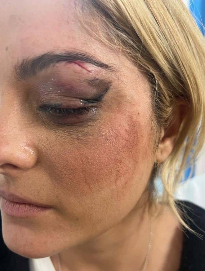 Bebe Rexha, nhạc US UK, tấn công ảnh 2 Bebe Rexha, nhac US UK, tan cong anh 2