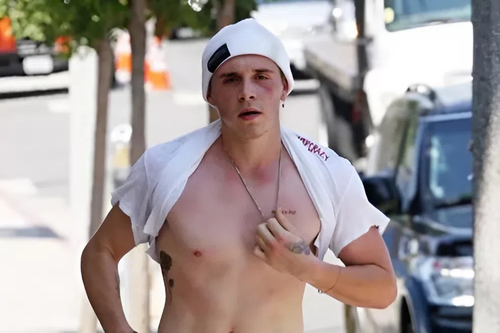 Brooklyn Beckham tro thanh 'tro cuoi' hinh anh