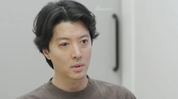 Can benh hiem gap cua Lee Dong Gun hinh anh