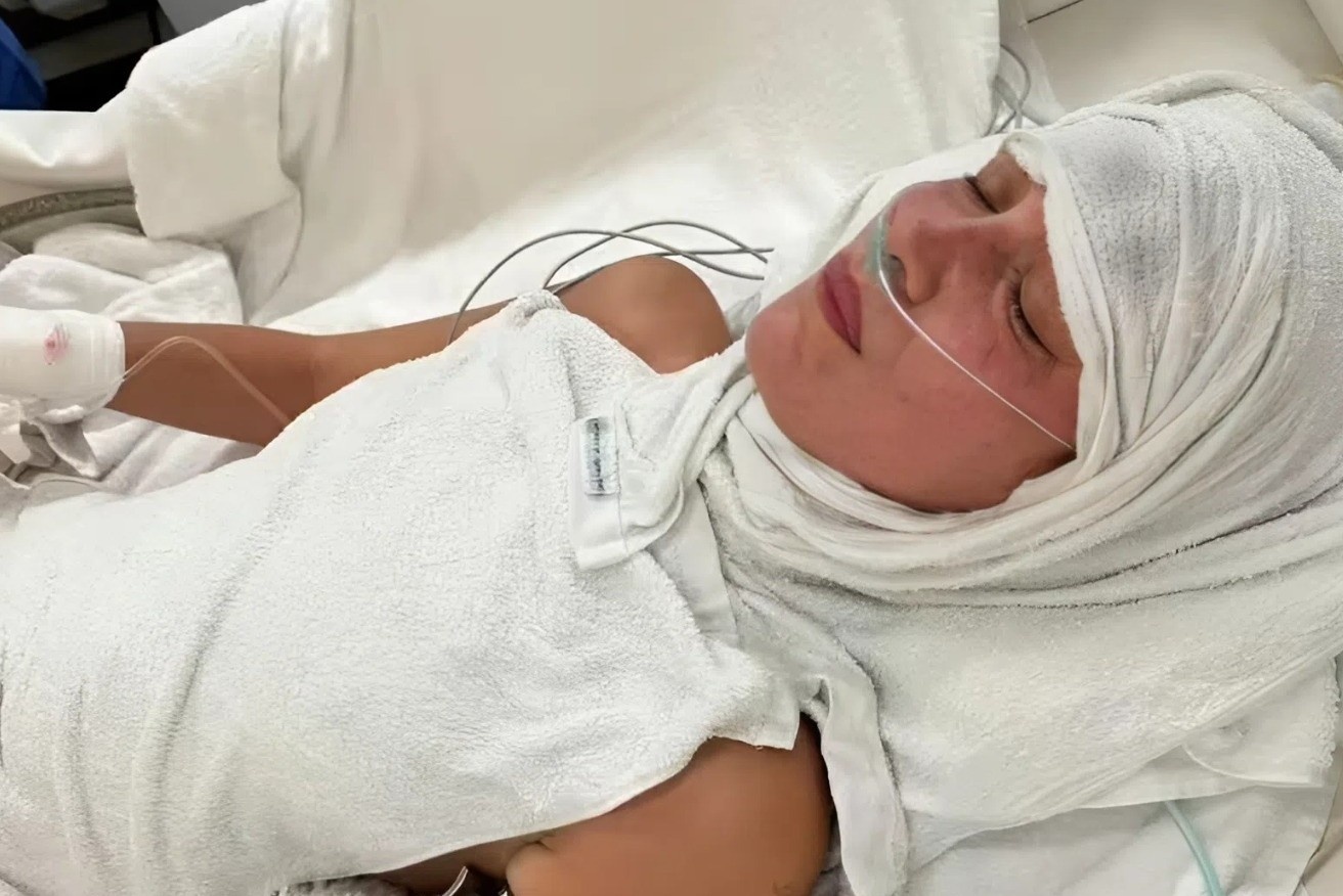 Ngay toi te cua sieu mau noi y hinh anh