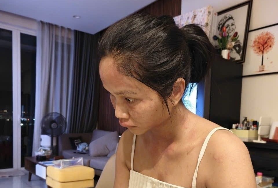 H'Hen Nie gay lo lang hinh anh