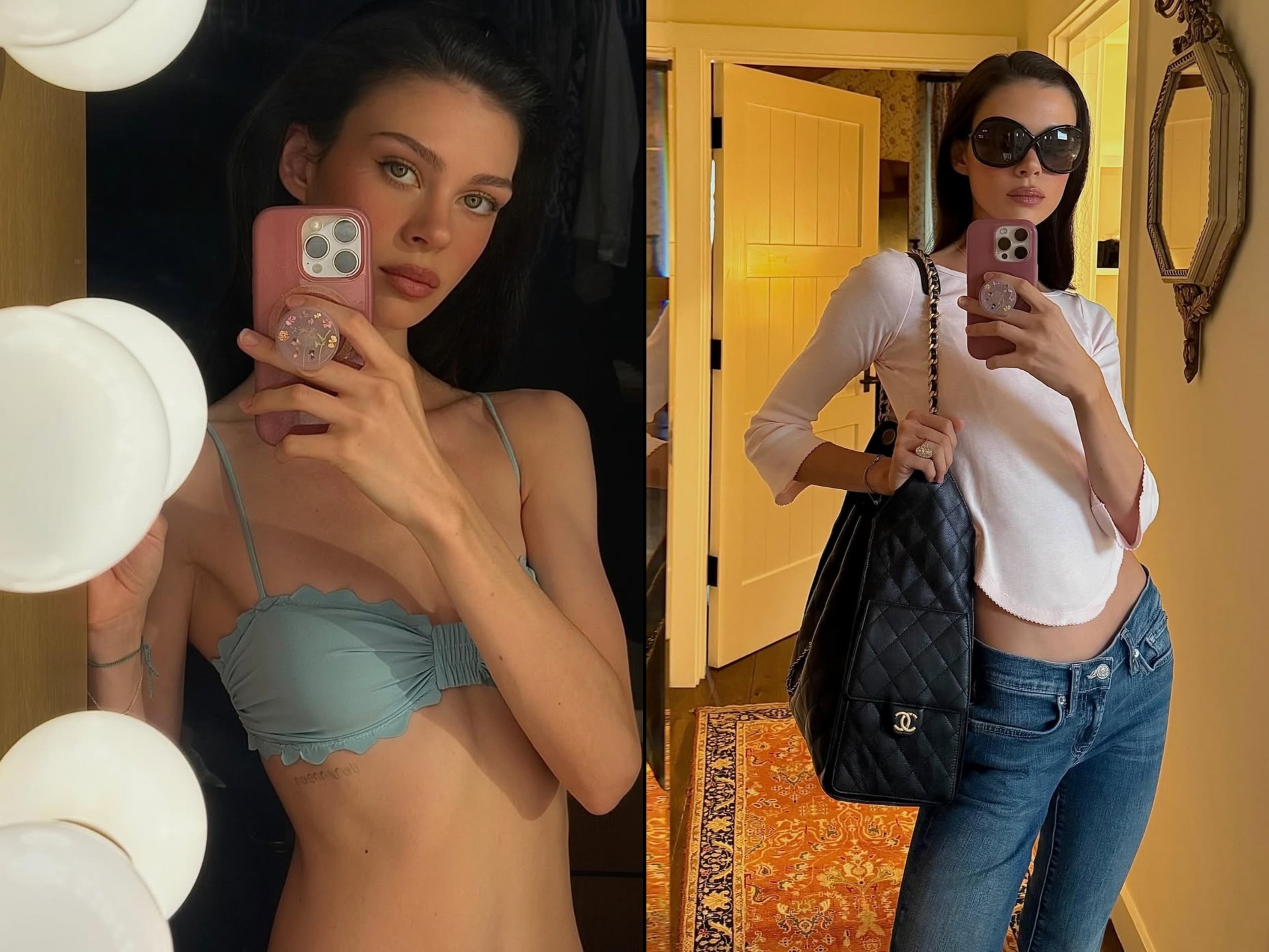 Vo Brooklyn Beckham gay lo lang hinh anh