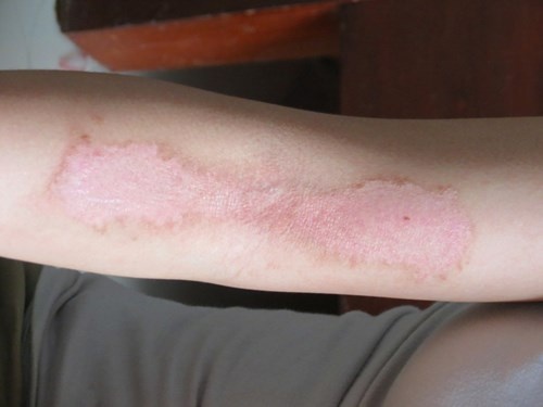 Sinh vien Hue khon kho vi bi kien ba khoang tan cong hinh anh