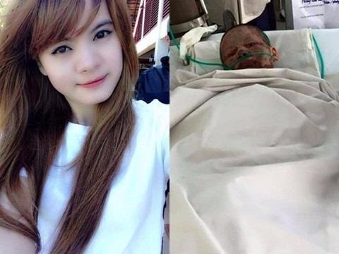 Co gai bi ban trai tuoi xang thieu song qua doi hinh anh