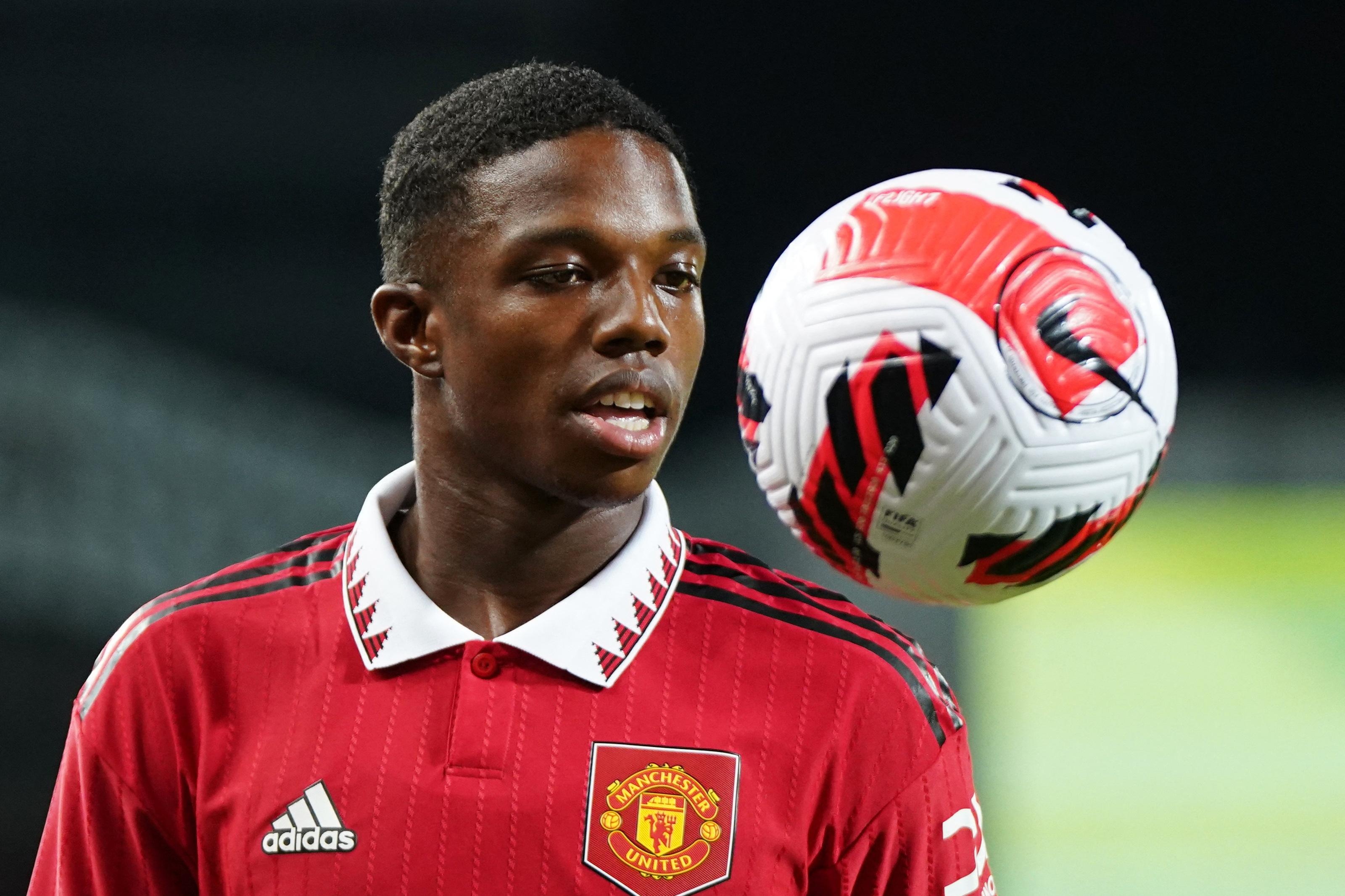 MU xuat hien ca chan thuong thu 8 hinh anh