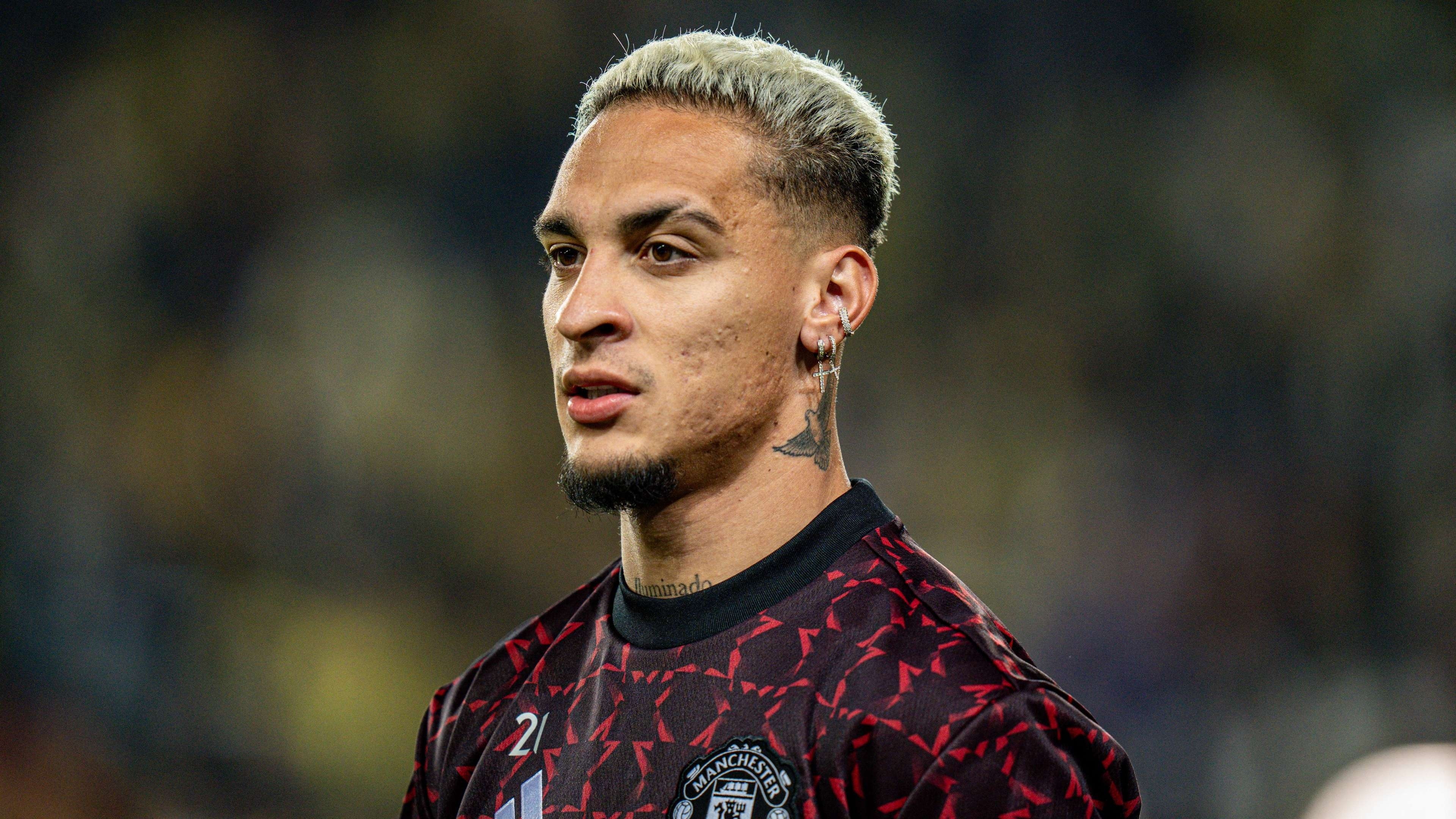 Antony nguy co nghi 6 tuan hinh anh