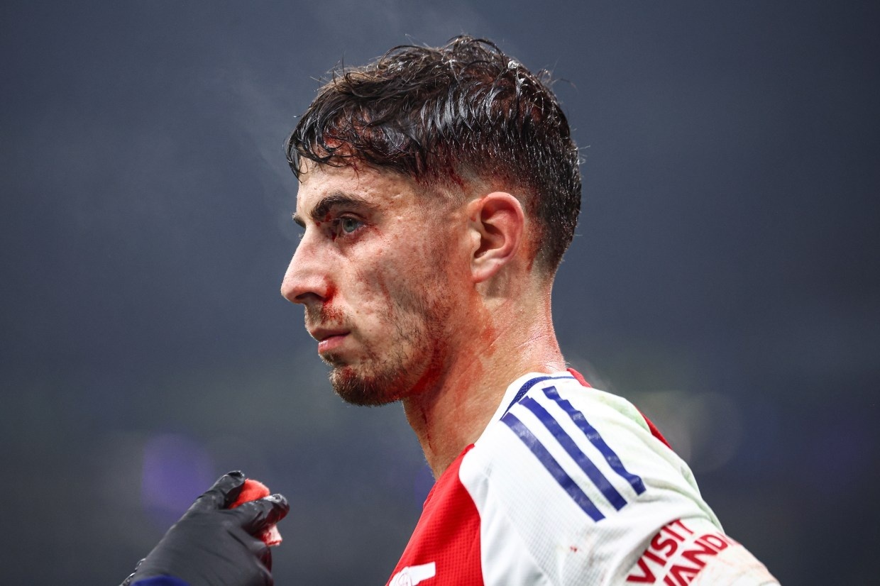 Havertz do mau hinh anh