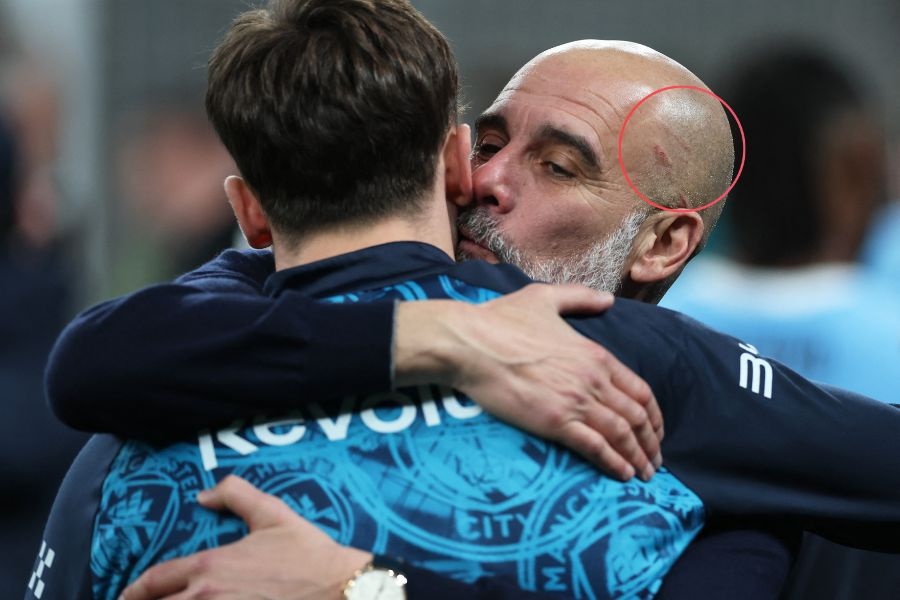 Pep Guardiola lai tu cao mat hinh anh