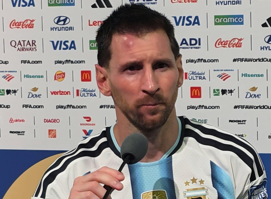 Vet sung cua Messi gay chu y hinh anh
