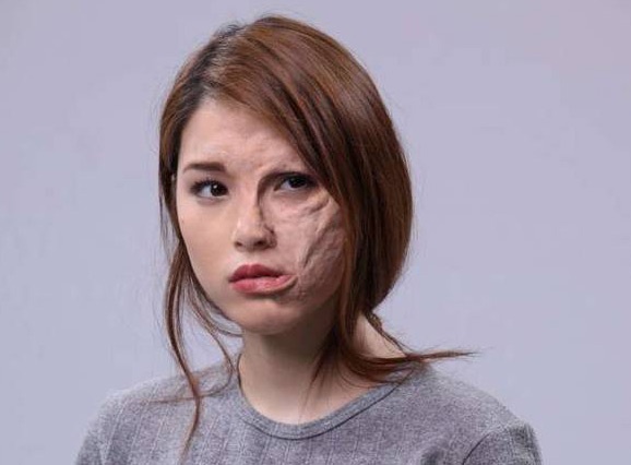 My nhan 9x Kylie Padilla chap nhan guong mat xau xi hinh anh