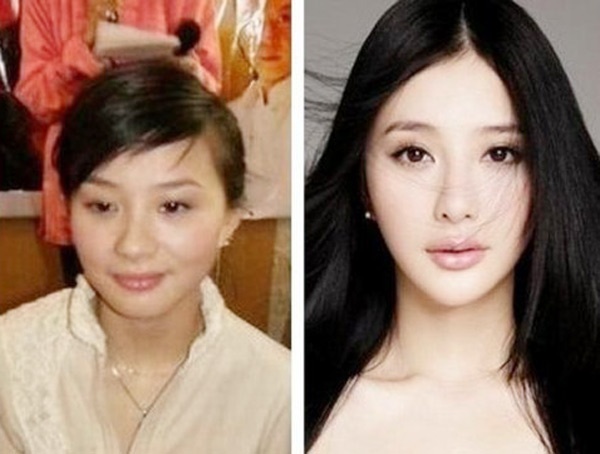 Hùng Nãi Cẩn là mỹ nhân dao kéo thành công ở Trung Quốc, ngày xưa và bây giờ là 2 gương mặt hoàn toàn khác nhau. Nhan sắc đã hỗ trợ cho sự nghiệp, giúp cô tỏa sáng qua các phim Mỹ nhân vô lệ, Tân Thủy hử…