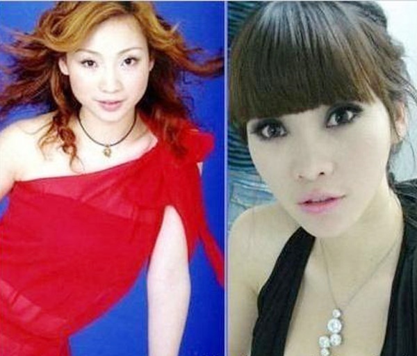 Liễu Nham là một trong số mỹ nhân đi lên nhờ quyết tâm và ý chí bản thân, từ một cô y tá xấu xí trở thành một mỹ nhân sở hữu gương mặt thanh tú cùng vòng 1 siêu khủng sau khi bước ra từ thẩm mỹ viện.