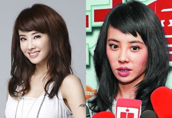 Không ít fan của Thái Y Lâm sửng sốt