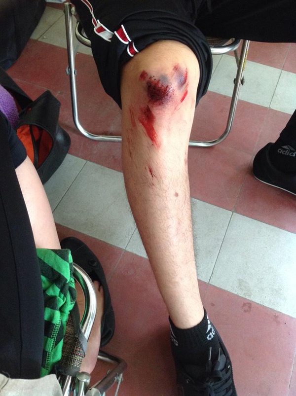 Thành Được vừa đọc kịch bản vừa hóa trang vết thương nơi đầu gối.