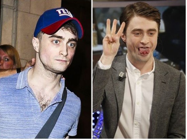 Dạo gần đây, thần sắc của Daniel Radcliffe không tốt (ảnh trái), khác hẳn với hình ảnh hồng hào hồi tháng 3 (ảnh phải)