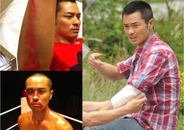 Trịnh Gia Dĩnh thường xuyên bị tai nạn khi đóng những pha võ thuật, hành động. 