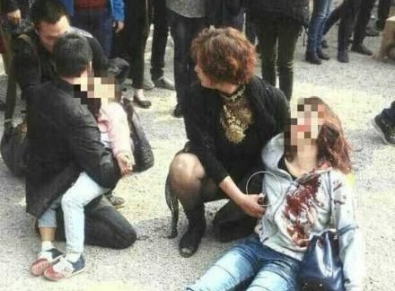 3 nguoi bi trong thuong, 1 nguoi chet vi chu ngua dong phim hinh anh