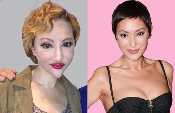 Goc khuat cua ‘tham hoa tham my’ showbiz Hong Kong hinh anh