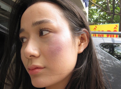 Bao Ky bi luu manh danh tim tai mat trong phim moi hinh anh