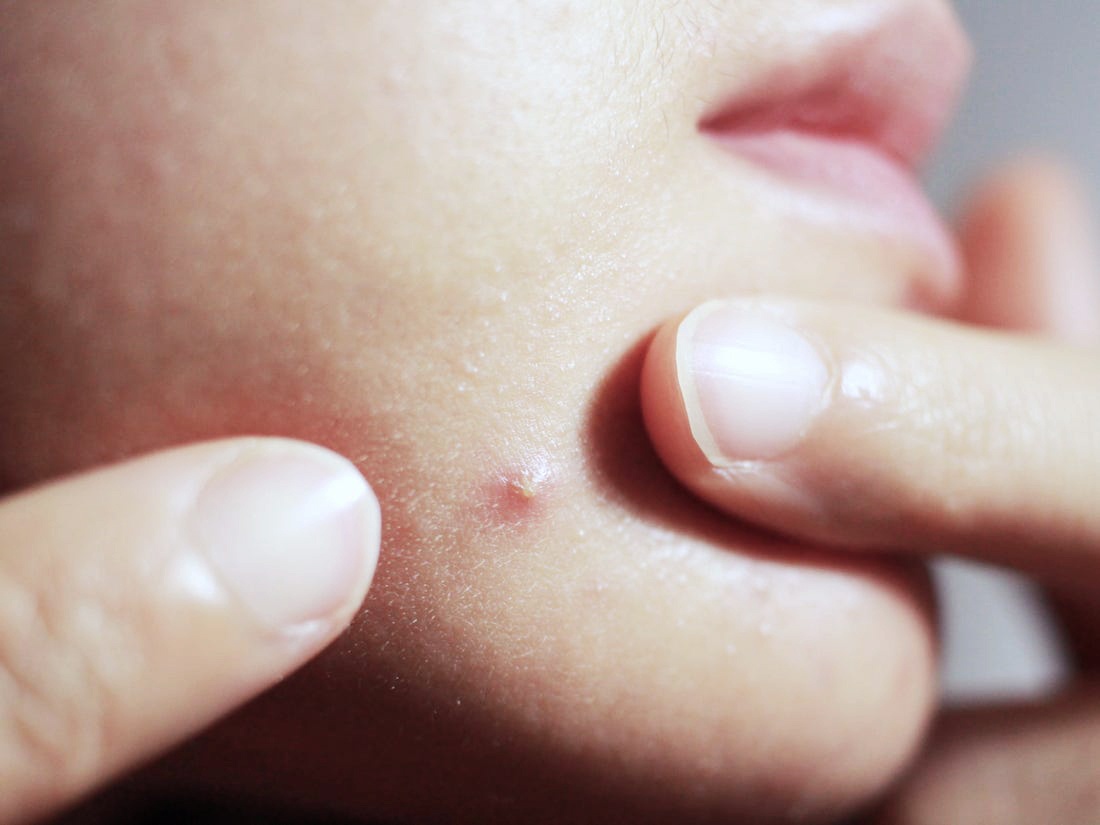 Nan mun tai nha anh 2