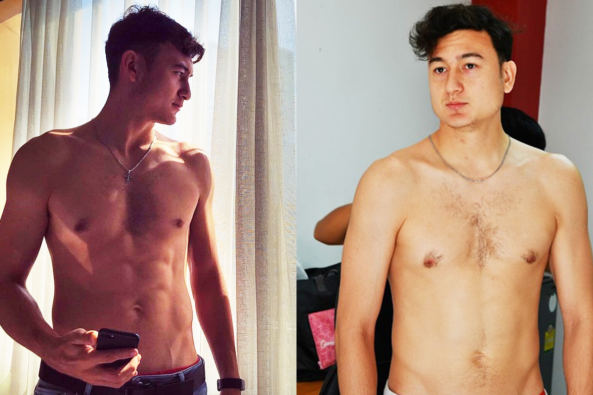 Vi sao nam gioi de bi mat co bung 6 mui nhu Dang Van Lam? hinh anh