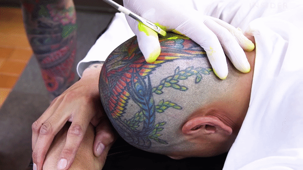 Tai sao hinh xam bam chat tren da qua nam thang? hinh anh