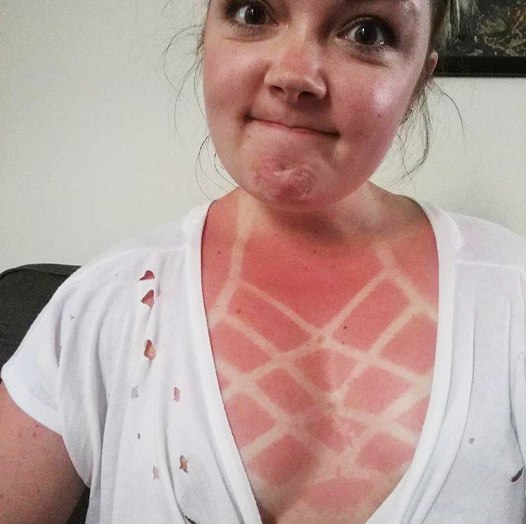 tac hai cua anh nang anh 1