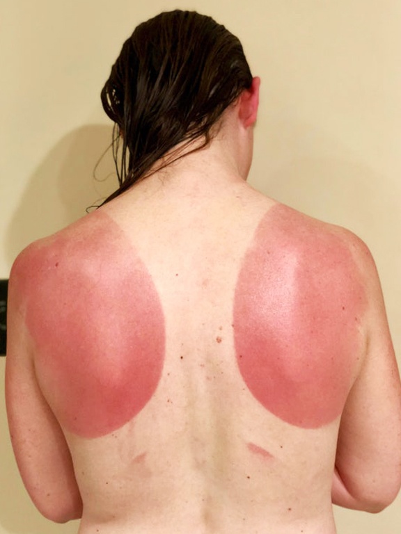 tac hai cua anh nang anh 2