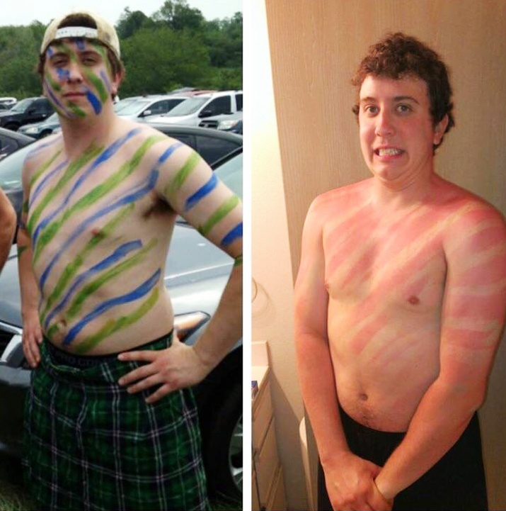 tac hai cua anh nang anh 3