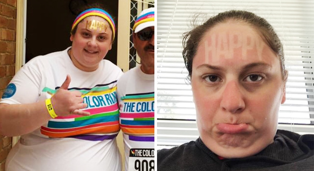 tac hai cua anh nang anh 4