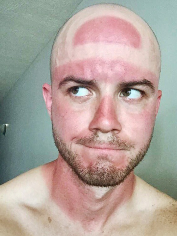 tac hai cua anh nang anh 5