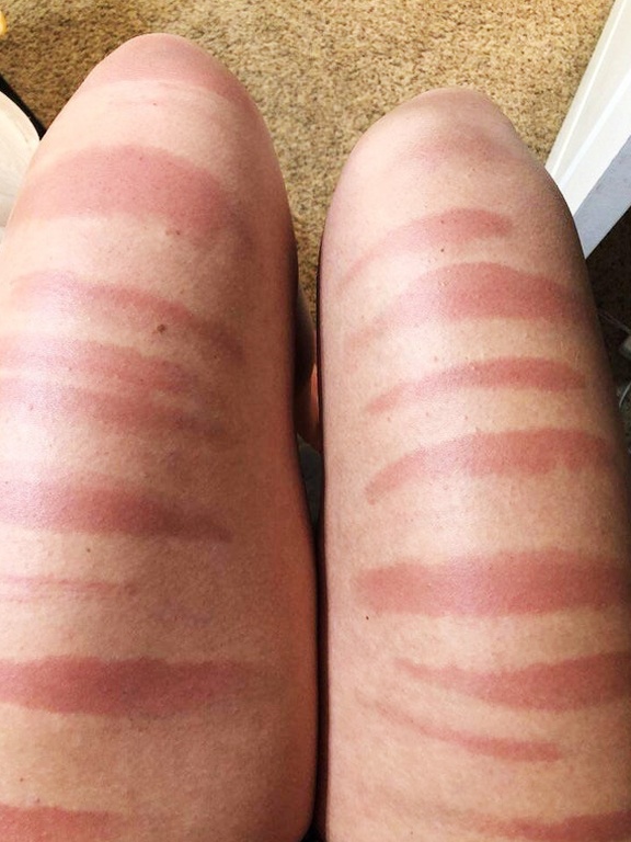 tac hai cua anh nang anh 7