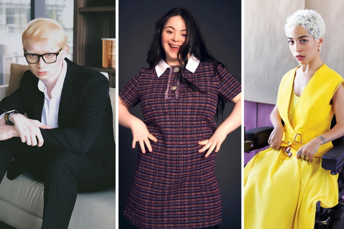 nguoi mau khuyet tat anh 1